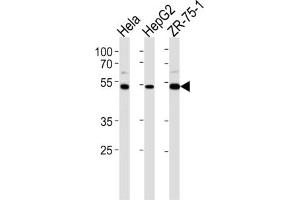 Western Blotting (WB) image for anti-Telomeric Repeat Binding Factor 2, Interacting Protein (TERF2IP) antibody (ABIN2997696) (RAP1 Antikörper)