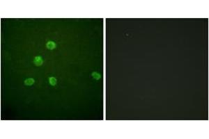 Immunofluorescence analysis of HepG2 cells, using FosB (Ab-27) Antibody. (FOSB Antikörper  (AA 12-61))