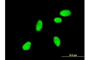 Immunofluorescence of monoclonal antibody to NEUROG2 on HeLa cell. (Neurogenin 2 Antikörper  (AA 36-112))