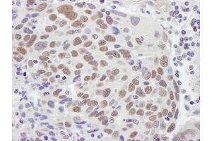Immunohistochemistry (IHC) image for anti-Mismatch Repair Protein 2 (MSH2) (C-Term) antibody (ABIN7453440) (MSH2 Antikörper  (C-Term))