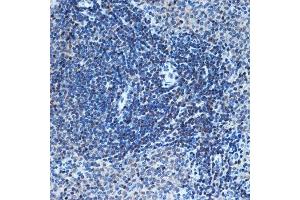 Immunohistochemistry (IHC) image for anti-Chromodomain Helicase DNA Binding Protein 3 (CHD3) antibody (ABIN7266363)