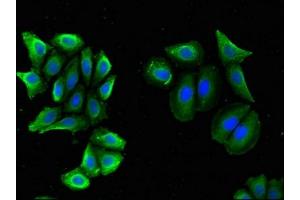 Immunofluorescent analysis of A549 cells using ABIN7145535 at dilution of 1:100 and Alexa Fluor 488-congugated AffiniPure Goat Anti-Rabbit IgG(H+L) (BACE2 Antikörper  (AA 84-157))