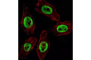 Fluorescent image of  cell stained with EZH2 Antibody (ABIN659002 and ABIN2838040) / SG100830. (EZH2 Antikörper)