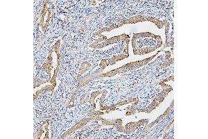 IHC analysis of CETP using anti-CETP antibody (ABIN7602439). (CETP Antikörper  (AA 77-353))