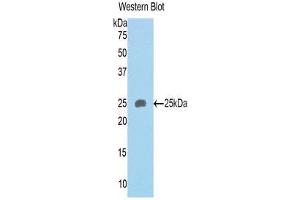 Western Blotting (WB) image for anti-Sema Domain, Immunoglobulin Domain (Ig), Transmembrane Domain (TM) and Short Cytoplasmic Domain, (Semaphorin) 4B (SEMA4B) (AA 31-240) antibody (ABIN1171802)