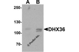 Western Blotting (WB) image for anti-DEAH (Asp-Glu-Ala-His) Box Polypeptide 36 (DHX36) (C-Term) antibody (ABIN1077418) (DHX36 Antikörper  (C-Term))