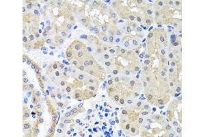 Immunohistochemistry of paraffin-embedded Mouse kidney using BSND Polyclonal Antibody at dilution of 1:100 (40x lens). (BSND Antikörper)