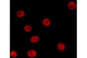 ABIN6267529 staining 293 by IF/ICC. (SAPK, JNK (pTyr185) Antikörper)
