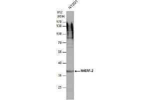 WB Image NHERF-2 antibody detects NHERF-2 protein by western blot analysis. (SLC9A3R2 Antikörper  (Center))