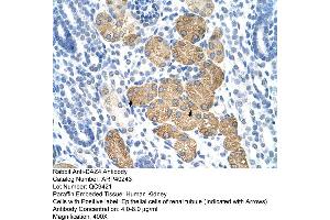 Rabbit Anti-DAZ4 Antibody  Paraffin Embedded Tissue: Human Kidney Cellular Data: Epithelial cells of renal tubule Antibody Concentration: 4. (DAZ4 Antikörper  (N-Term))