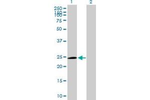 Western Blot analysis of TRIM50C expression in transfected 293T cell line by TRIM50C MaxPab polyclonal antibody. (TRIM74 Antikörper  (AA 1-249))