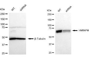 Western blotting analysis using HNRNPM antibody (ABIN7798901).