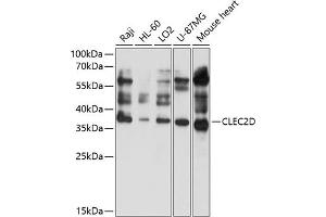 Western blot analysis of extracts of various cell lines, using CLEC2D antibody (ABIN6130113, ABIN6138707, ABIN6138708 and ABIN6214667) at 1:1000 dilution. (CLEC2D Antikörper  (AA 60-154))
