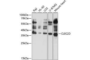 Western Blotting (WB) image for anti-C-Type Lectin Domain Family 2, Member D (CLEC2D) (AA 60-154) antibody (ABIN6138707)
