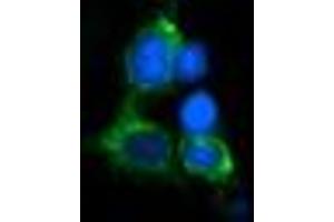 Image no. 2 for anti-Myelin Protein Zero-Like 2 (MPZL2) antibody (ABIN1499552)