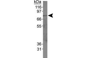 Western blot analysis of ACSL1 in HepG2 whole cell lysates using ACSL1 polyclonal antibody . (ACSL1 Antikörper  (AA 1-100))