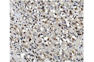 IHC analysis of OGT using anti-OGT antibody (ABIN3043893).