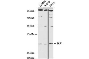 Western blot analysis of extracts of various cell lines, using SKP1 antibody (ABIN6130683, ABIN6147817, ABIN6147819 and ABIN6216158) at 1:1000 dilution. (SKP1 Antikörper  (AA 1-163))