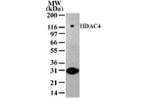 HDAC4 antibody (pAb) tested by Western blot. (HDAC4 Antikörper  (AA 194-209))
