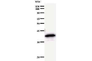 Western Blotting (WB) image for anti-Bromodomain Containing 3 (BRD3) antibody (ABIN933105) (BRD3 Antikörper)