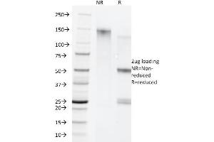 SDS-PAGE Analysis Purified Cytokeratin 5/8 Monoclonal Antibody (C-50). (Keratin 5/8 Antikörper)