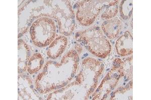 Used in DAB staining on fromalin fixed paraffin- embedded kidney tissue (GDF11 Antikörper  (AA 299-407))