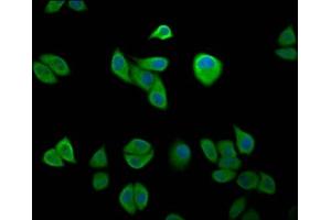 Immunofluorescence staining of Hela cells with ABIN7151572 at 1:200, counter-stained with DAPI. (IKAP/p150 Antikörper  (AA 1107-1258))