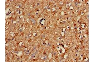 Immunohistochemistry of paraffin-embedded human brain tissue using ABIN7170654 at dilution of 1:100 (SPRY2 Antikörper  (AA 2-97))