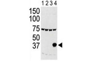 Western blot testing of Aurora-C antibody and lysate of 293 cells expressing 1) Flag tag, 2) Flag-tagged -A, 3) -B and 4) Aurora-C. (Aurora Kinase C Antikörper  (AA 1-30))