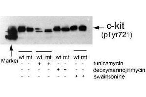 Image no. 1 for anti-Mast/stem Cell Growth Factor Receptor (KIT) (pTyr721) antibody (ABIN196993)