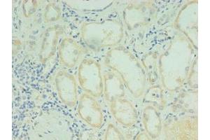 Immunohistochemistry of paraffin-embedded human kidney tissue using ABIN7167836 at dilution of 1:100 (RDH12 Antikörper  (AA 1-316))