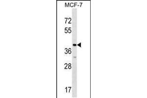 Western blot analysis in MCF-7 cell line lysates (35ug/lane). (MRPL1 Antikörper  (N-Term))