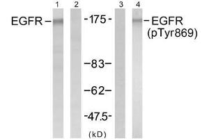 Western blot analysis of extract from A431 cells untreated or treated with EGF (200ng/ml, 5min), using EGFR (Ab-869) antibody (E021222, Lane1 and 2) and EGFR (Phospho-Tyr869) antibody (E011229, Lane 3 and 4). (EGFR Antikörper)