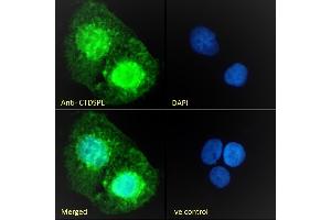 (ABIN263205) Immunofluorescence analysis of paraformaldehyde fixed A431 cells, permeabilized with 0.