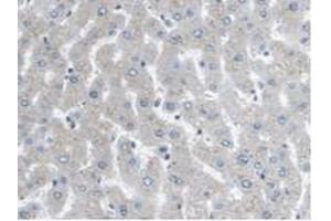IHC-P analysis of Human Liver Tissue, with DAB staining. (ARPC4 Antikörper  (AA 3-165))