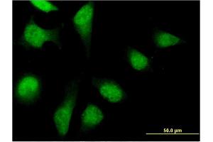 Immunofluorescence of monoclonal antibody to PFDN2 on HeLa cell. (PFDN2 Antikörper  (AA 1-154))