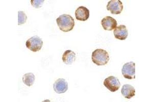 Immunocytochemistry of caspase-6 in MCF7 with AP30201PU-N caspase-6 antibody at 1 μg/ml. (Caspase 6 Antikörper  (Intermediate Domain))