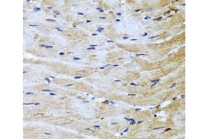 Immunohistochemistry of paraffin-embedded Mouse heart using M6PR Polyclonal Antibody at dilution of 1:100 (40x lens). (M6PR Antikörper)