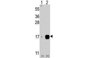 Western blot analysis of IFITM3 (arrow) using rabbit IFITM3 polyclonal antibody . (IFITM3 Antikörper  (Internal Region))