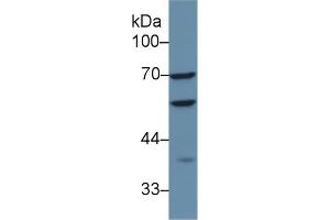 Detection of CAP1 in Human HepG2 cell lysate using Polyclonal Antibody to Adenylyl Cyclase Associated Protein 1 (CAP1) (CAP1 Antikörper  (AA 38-149))