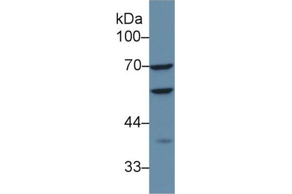 CAP1 Antikörper  (AA 38-149)