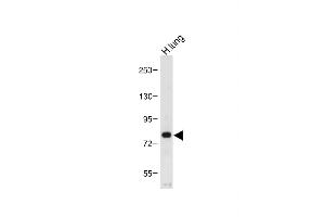 Anti-MUC20 Antibody (C-term) at 1:1000 dilution + Human lung tissue lysate Lysates/proteins at 20 μg per lane. (MUC20 Antikörper  (C-Term))
