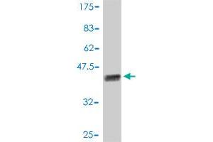 Western Blot detection against Immunogen (41. (PFN1 Antikörper  (AA 1-140))