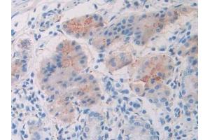 Immunohistochemistry (IHC) image for anti-Slit Homolog 1 (SLIT1) (AA 647-835) antibody (ABIN7438364)