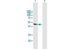 Western Blot analysis of TBC1D16 expression in transfected 293T cell line by TBC1D16 MaxPab polyclonal antibody. (TBC1D16 Antikörper  (AA 1-405))