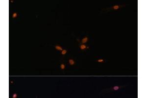 Immunofluorescence analysis of C6 cells using SMAD7 Polyclonal Antibody at dilution of 1:100. (SMAD7 Antikörper)