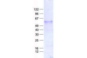 Validation with Western Blot (SFRP4 Protein (His tag))