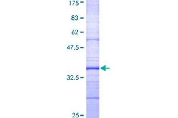 Dopamine d2 Receptor Protein (AA 1-110) (GST tag)