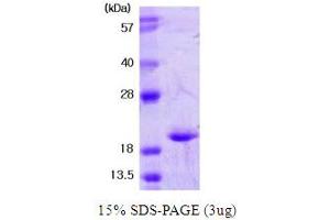 SOD1 Protein (AA 1-154)