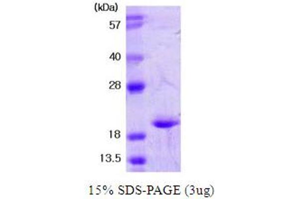 SOD1 Protein (AA 1-154)